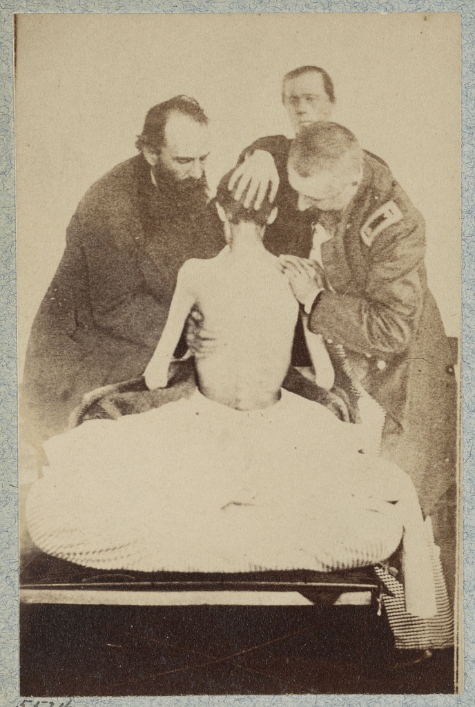 Photograph: an emaciated young man, seen from behind with bare back and protruding ribs, is examined by three men, one in Union uniform