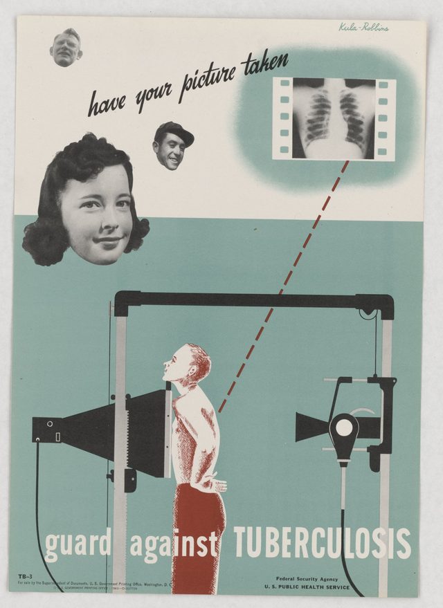 Guard against tuberculosis, have your picture taken