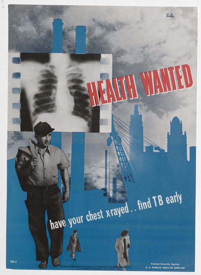Health wanted: have your chest x-rayed, find TB early