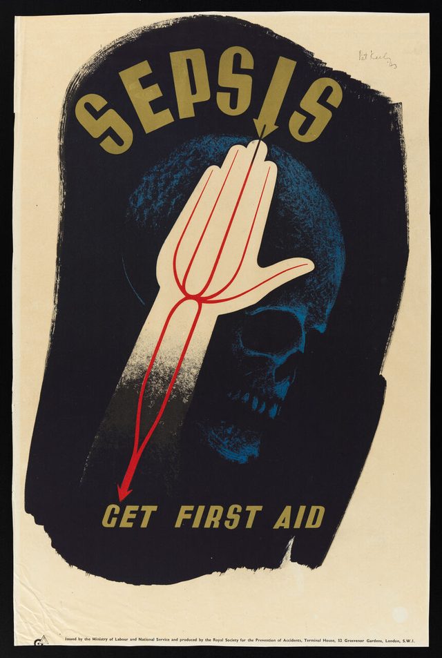Sepsis: Get First Aid